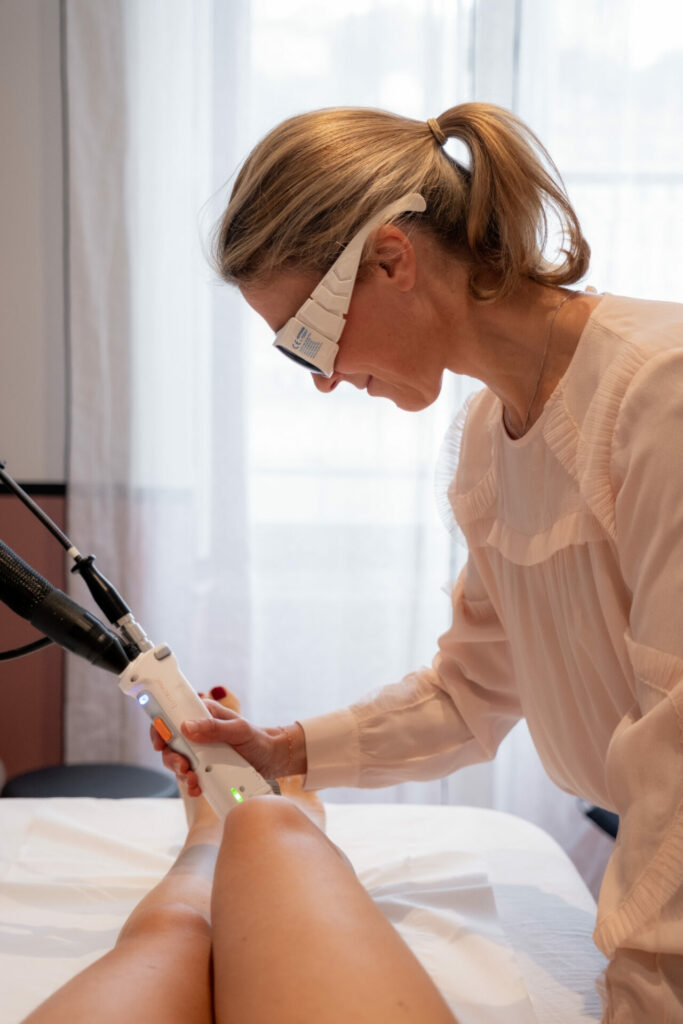 épilation définitive au laser